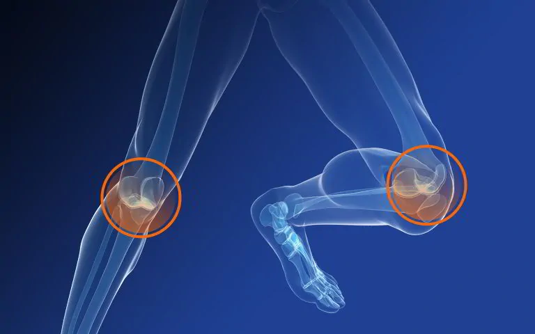 illustration of joint paint in the knees